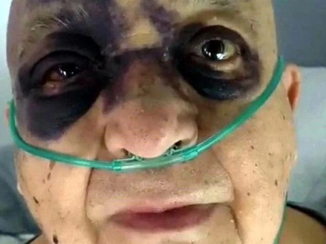 Luis de Alba aclara su estado de salud tras ser hospitalizado por accidente