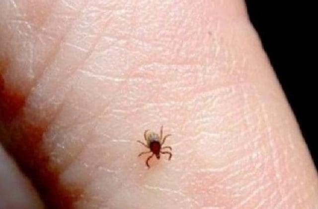 Rickettsiosis casi triplica los registros del año pasado: Salud 