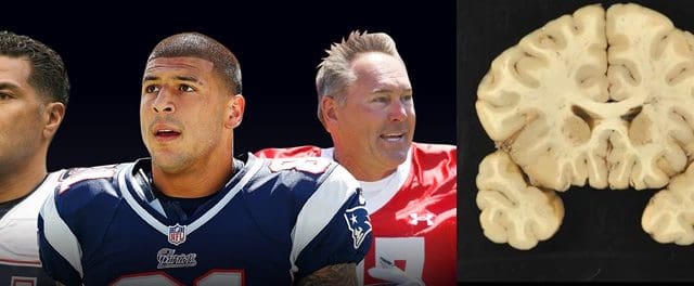 NFL en aprietos por jugadores fallecidos por CTE